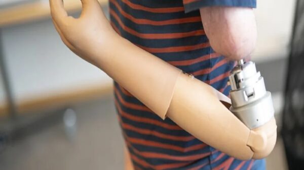 Entregará DIF Morelos prótesis para brazos o manos de manera gratuia a personas mayores de seis años